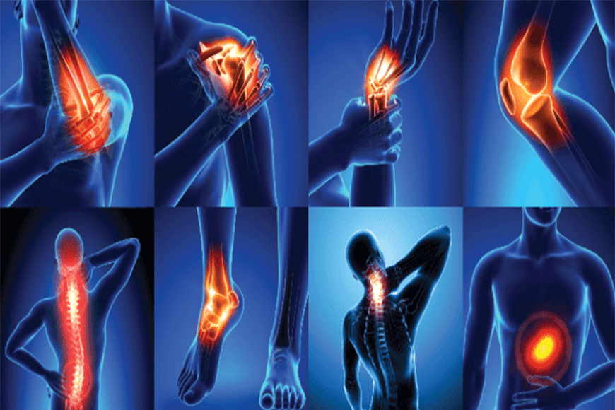 Osteoarthritis symptoms and treatment.