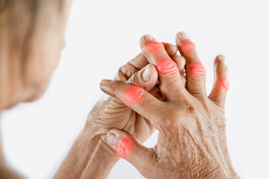 rheumatoid arthritis causes and symptoms 