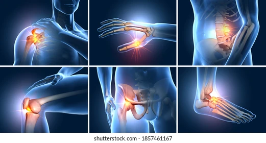 Osteoarthritis causes and symptoms